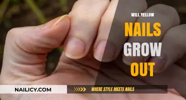 Yellow Nails: Will They Grow Out?