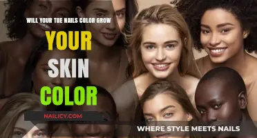 Toe Nails: Skin Tone Impact