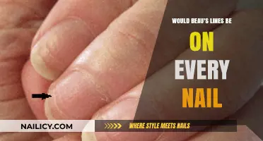 Do Beau's Lines Appear on All Nails? Uncovering the Truth