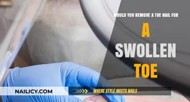 Toe Nail Removal: A Swollen Toe Solution?