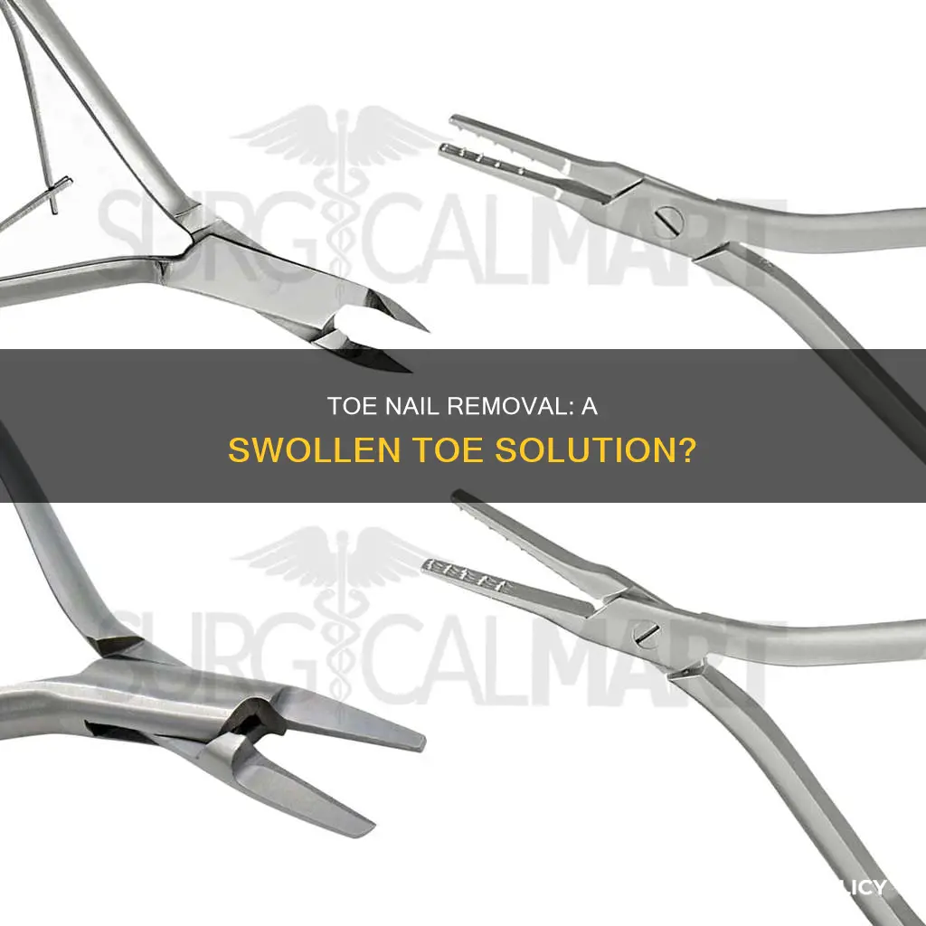 would you remove a toe nail for a swollen toe
